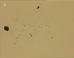 Dispersion of carbon nanotubes using optical tweezer cum microdissection combi system (field of view 80µm).
