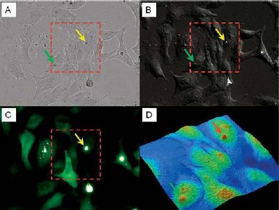 Using AFM to generate additional information to optical microscopy. Mutant YFP-tagged htt protein forms bright aggregates (images A, bright fi eld and B, DIC, image C, epifluorescence, yellow arrows) that are also easily recognized in the AFM topographic channel (image D, red arrow in). In addition, changes in cell topology caused by other cellular substructures similar to that caused by aggregates could also be detected by the AFM scan (image D, green arrow). Optical images taken with a 20x objective. AFM scan: 90x90x3µm.