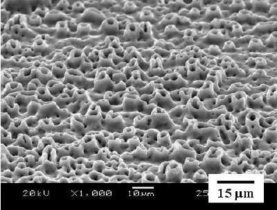 SEM micrographs of surface-modified titanium implants: Morphology of MAO treated surface (top) , anodized surface (middle) and cross-sectional view of HA coating on Ti substrate (bottom).
