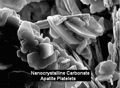 Nanocrystalline carbonate apatite platelets produced using the Sol-Gel Process.