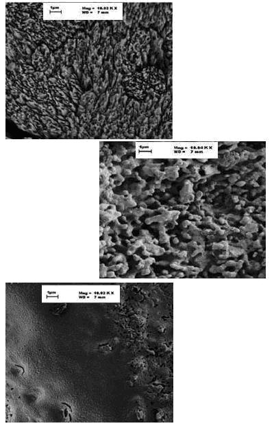 Stages of nanocrystalline hydroxyapatite-coated coralline apatite formation. (top) Coral Structure. (middle) Coral after conversion to hydroxyapatite with the hydrothermal method. (bottom) Converted and nanocoated coralline apatite.