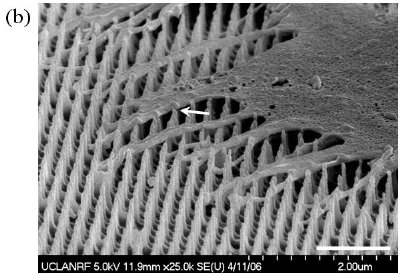 Cell adhesions on 3-D sharp-tip nanotopography5,6. The SEM images of fibroblast cells