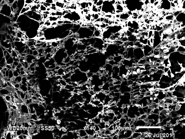 SEM image of a 3D scaffold created using a nanocomposite of chitosan and carbon nanotubes, by L Bugnicourt, S. Trigueros and S Contera, unpublished.