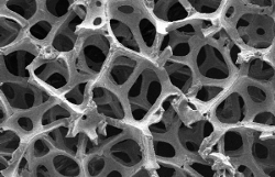 SEM image of 3D graphene foam.