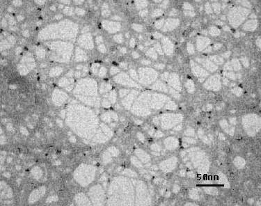 Nanocellulose up-close: This TEM image of a nanocellulose membrane shows the individual cellulose nanofibers.