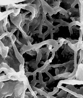 Natural nanostructures such as those in sponges have inspired researchers to create artificial materials for a variety of medical applications.