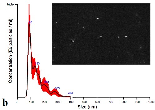 Initial size distribution profiles and particle images for urine-derived exosomes.