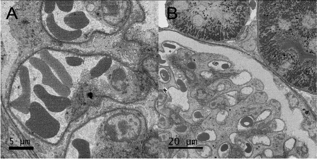 Mouse kidney SBFSEM images acquired with a 3View system on an SEM in high vacuum. Image A is an extract of a 4k x 4k image acquired at 900 V. Image B is an 8k x 8k image acquired with 10nm pixels at 1.0 kV.