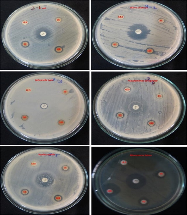 Antibacterial effects of green synthesized AgNPs from H. isora