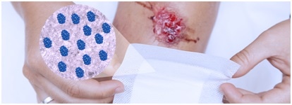 Wound Healing and Wound Dressing