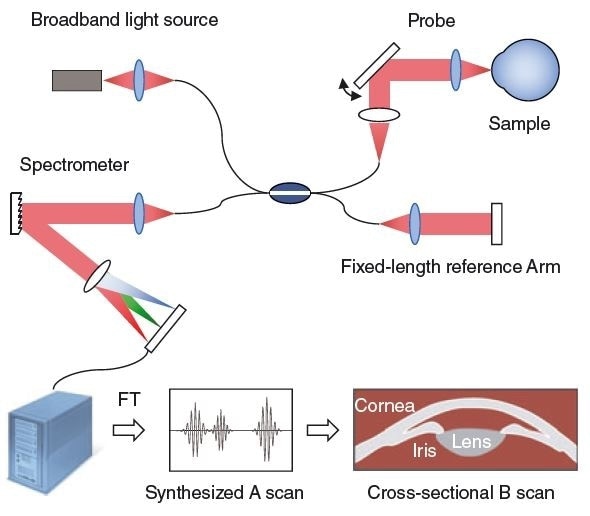 Spectral domain optical coherence tomography (SD-OCT) system with lateral probe beam displacement for cross-sectional B scan imaging. A computer converts the spectrometer data to a synthesized A scan by means of a Fourier Transform. (FT)