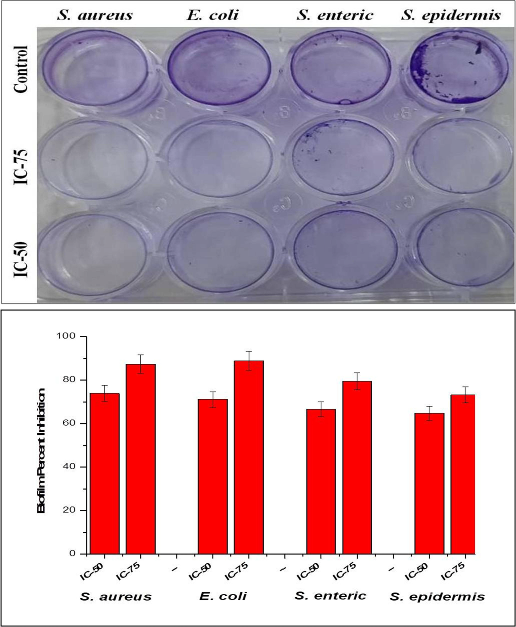 Image and graph showing inhibition of biofilm formation of silver nanoparticles. All the data were expressed in the mean ± SD of three experiments.