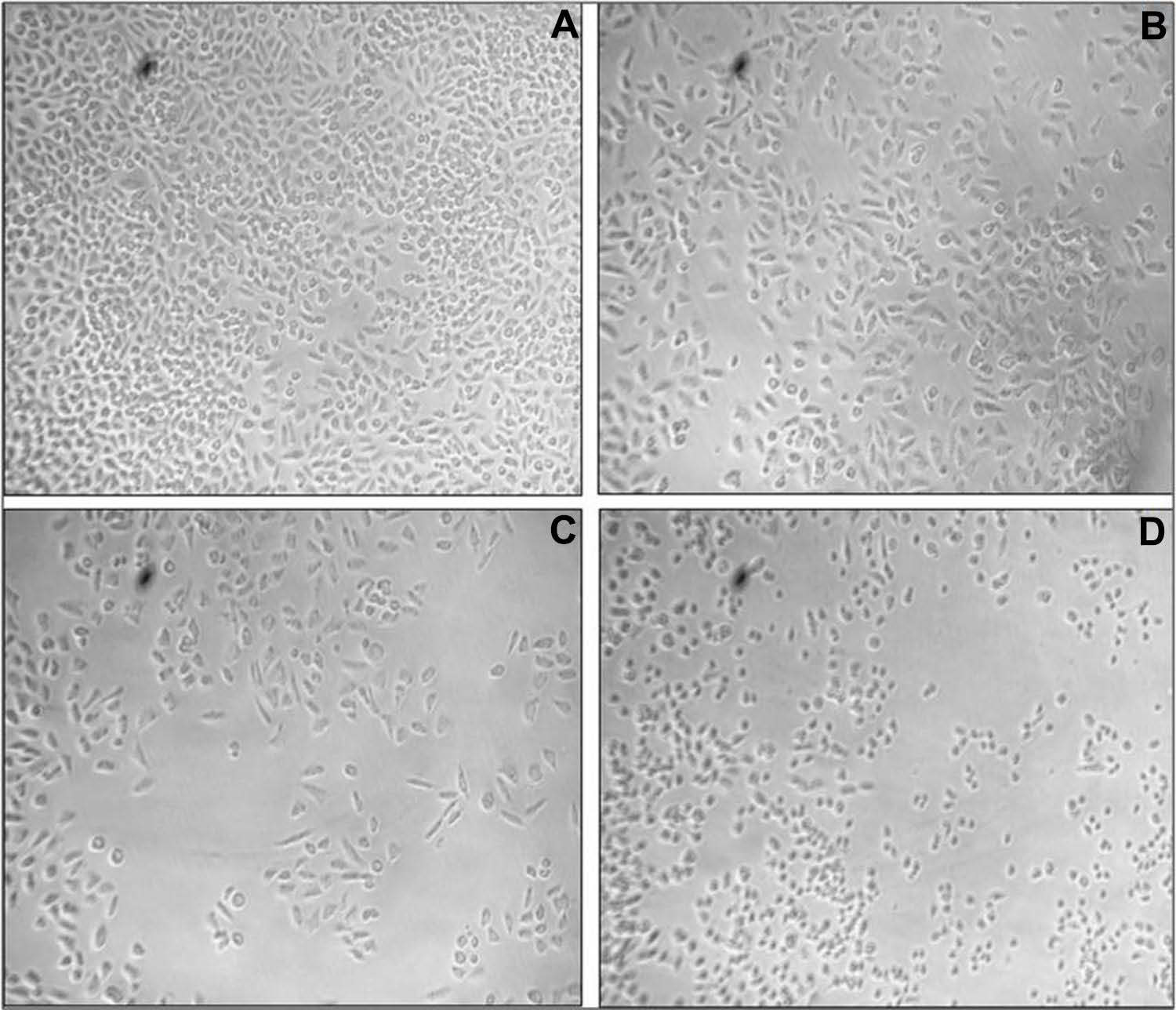 The cytomorphological study of AgNPs treated A549 cells (A) control, (B) IC25 (C) IC50, (D) IC75 at 20× magnification.