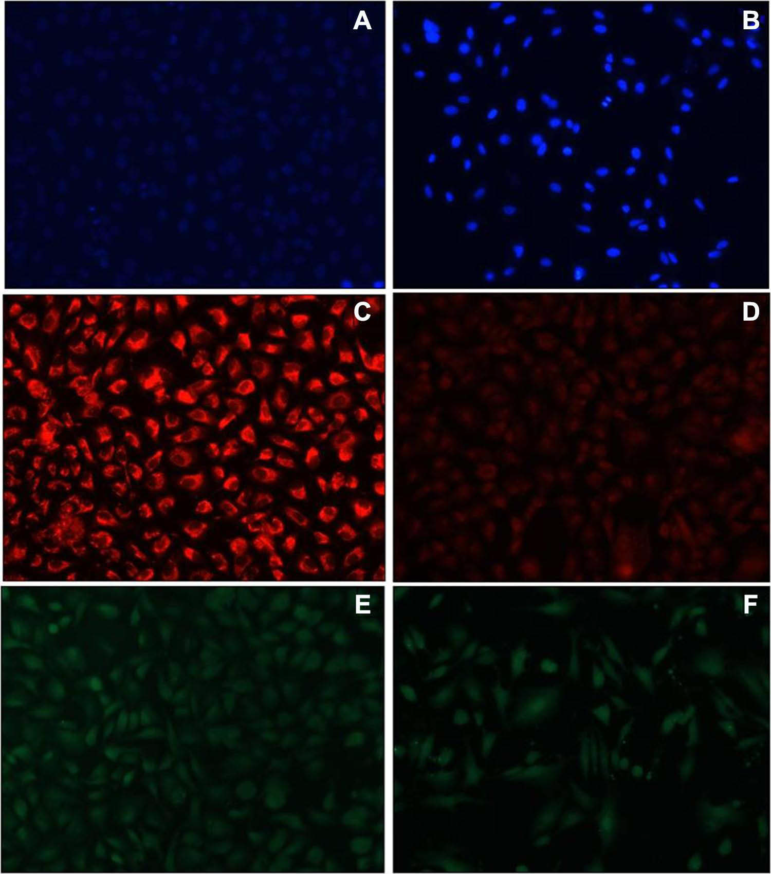 Images observed for AgNPs treated cells under phase contrast microscope after 48 hours of treatment for DAPI staining (A) control (B) treated cells; for Mito Tracker Red staining (C) control (D) treated cells and for DCFDA staining (E) control (F) treated cells.