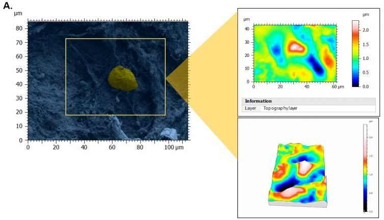 Topography of perifollicular ECM before and after menopause. SEM images were colorized with SMILE VIEW ™ Map software, based on MountainsSEM®, to highlight the presence of follicles (yellow) and distinguish them from the ECM (blue). Topography rendering shows a remodeling and difference in perifollicular ECM between reproductive age (A) and menopausal (B) tissues.