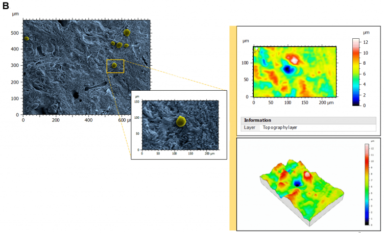 Topography of perifollicular ECM before and after menopause. SEM images were colorized with SMILE VIEW ™ Map software, based on MountainsSEM®, to highlight the presence of follicles (yellow) and distinguish them from the ECM (blue). Topography rendering shows a remodeling and difference in perifollicular ECM between reproductive age (A) and menopausal (B) tissues.