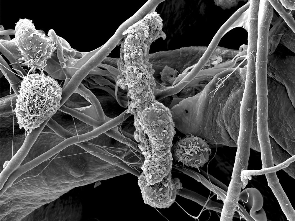 Scanning electron microscopy of human connective tissue with erythrocytes and blood vessel. Collagen fibres and single cells.