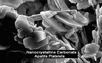 Nanohydroxyapatite Coatings, Powders and Platelets Produced via Sol-Gel Methods for Medical Applications