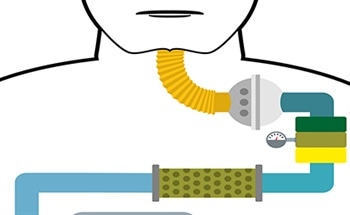 An Artificial Throat with Sound Sensing Abilities Developed Using Graphene