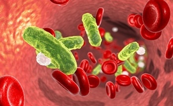 A New Mass Spectrometry Method for Detecting Sepsis