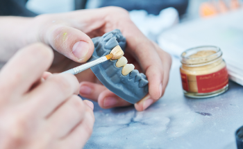 Improving Dental Restorative Materials Using Nanotechnology