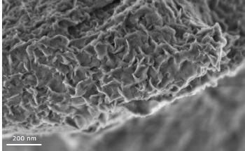 The Evolution of Scanning Electron Microscopy