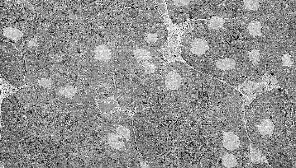 Rat pancreatic tissue imaged with FAST-EM.