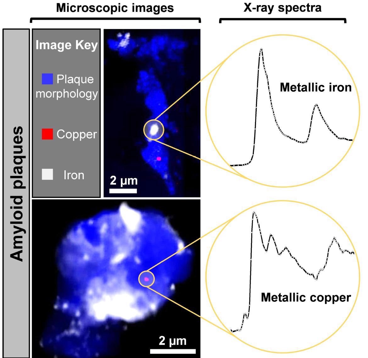 Study Reveals Presence of Nanoscale Metallic Particles in the Human Brain.