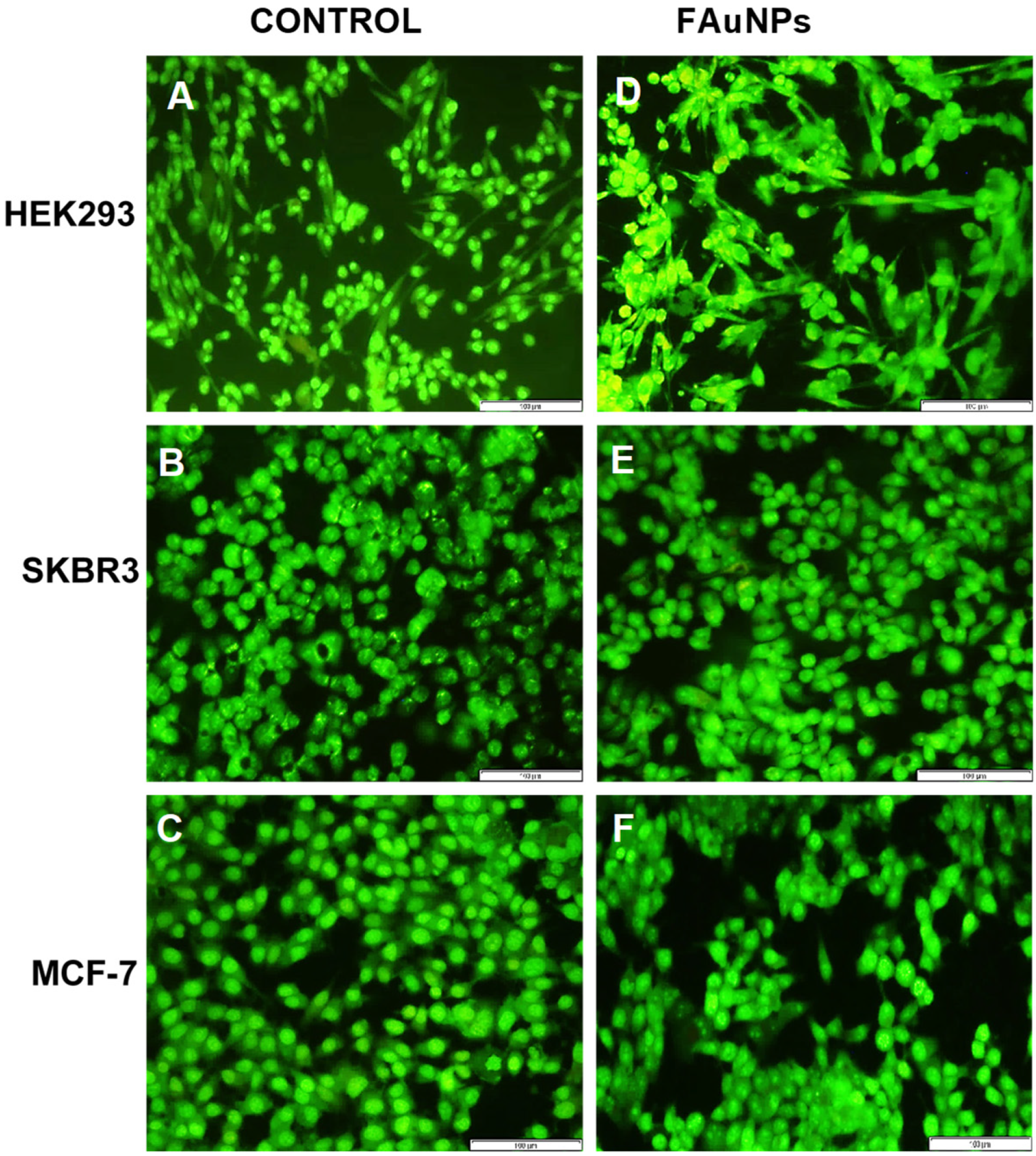 Fluorescent images from the acridine orange/ethidium bromide apoptosis assay in the HEK293, SKBR3 and MCF-7 cell lines at 20× magnification. Control = untreated (A) HEK293 (B) SKBR3 and (C) MCF-7 cells. FAuNP treated cells (D) HEK293 cells with Au-CS at the suboptimum ratio, (E) SKBR3 cells with Au-CS-FA-His at the supraoptimum ratio and (F) MCF-7 cells with Au-CS at the optimum ratio. Scale bar = 100 µm.