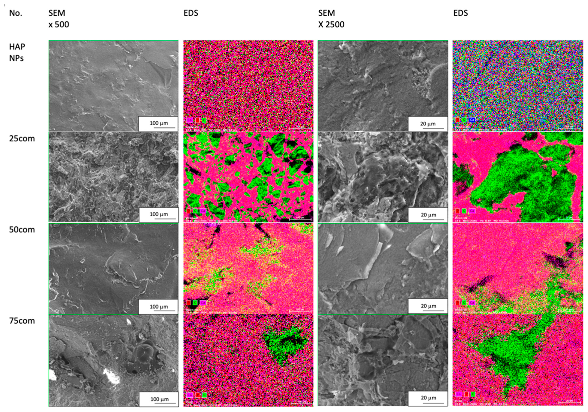 Collection of SEM images; EDS mapping for HAP NPs sample and 25com, 50com, and 75com composites.
