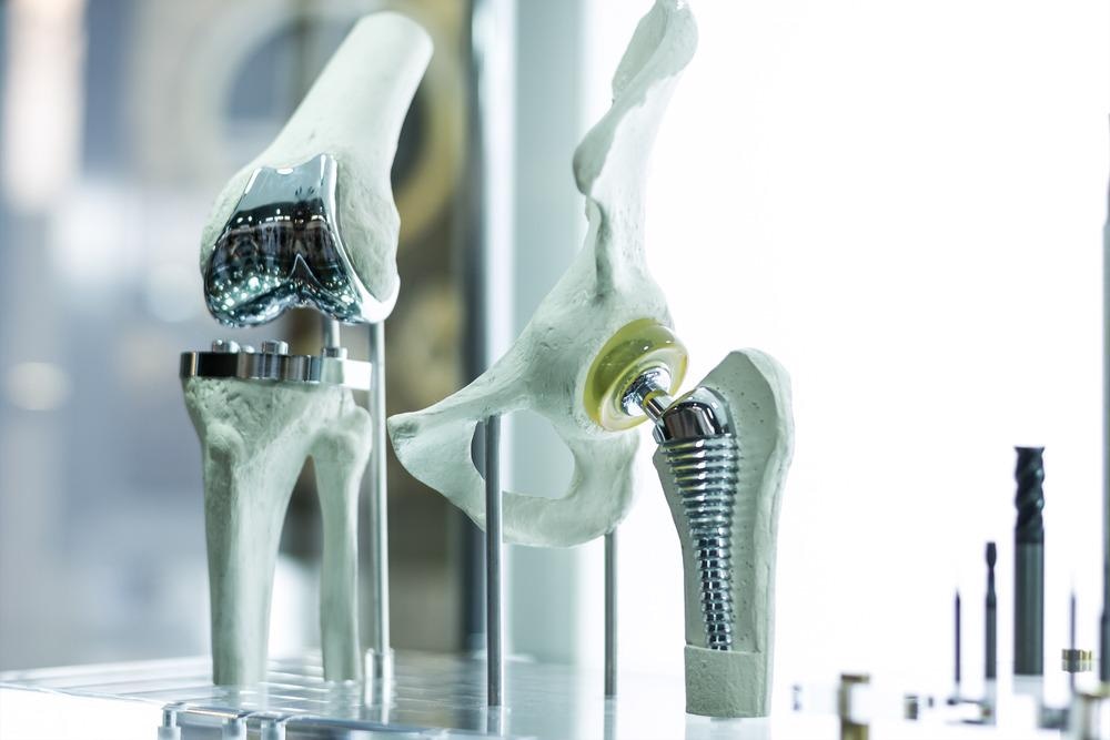 Potential Bioresorbable Bone Implant Developed from Inverse Nanocomposites