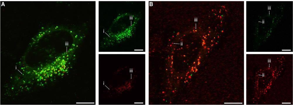 Subcellular distribution of the 40 nm and 100 nm particles. Cells were exposed for 24 h to both the 40 nm and 100 nm particles simultaneously and then observed using confocal fluorescence microscopy. (A) Concentration of 100 and 40 nm particles 20 and 100 µg/mL, respectively (0.060 nM and 4.7 nM; conditions correspond to the highest 40 nm particle concentration in Figures 2 and S3). (B) Concentration of 40 and 100 nm particles 6.25 and 80 µg/mL, respectively (0.30 and 0.24 nM; conditions correspond to the highest 100 nm particle concentration in Figures 4 and S4). The larger images show overlaps of both fluorescence colours, while the smaller images show the individual colours. (Green) 40 nm particles; (red) 100 nm particles. Arrows show examples of (i) 40 nm particle( s) (green) in the absence of 100 nm particles; (ii) 100 nm particle(s) (red) in the absence of 40 nm particles; (iii) 40 and 100 nm particles in the same location. The results show that the two particles often end up in the same location, but not always. All scale bars correspond to 10 µm.