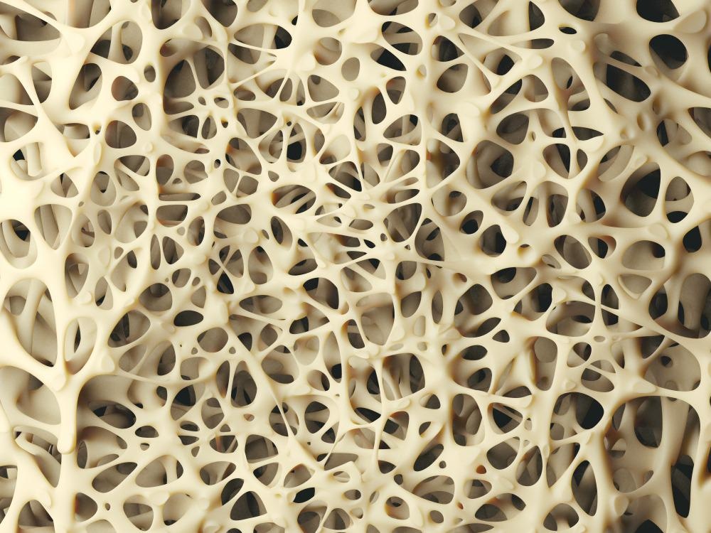 Nanocomposite Hydrogel Improves Bone Repair Treatment