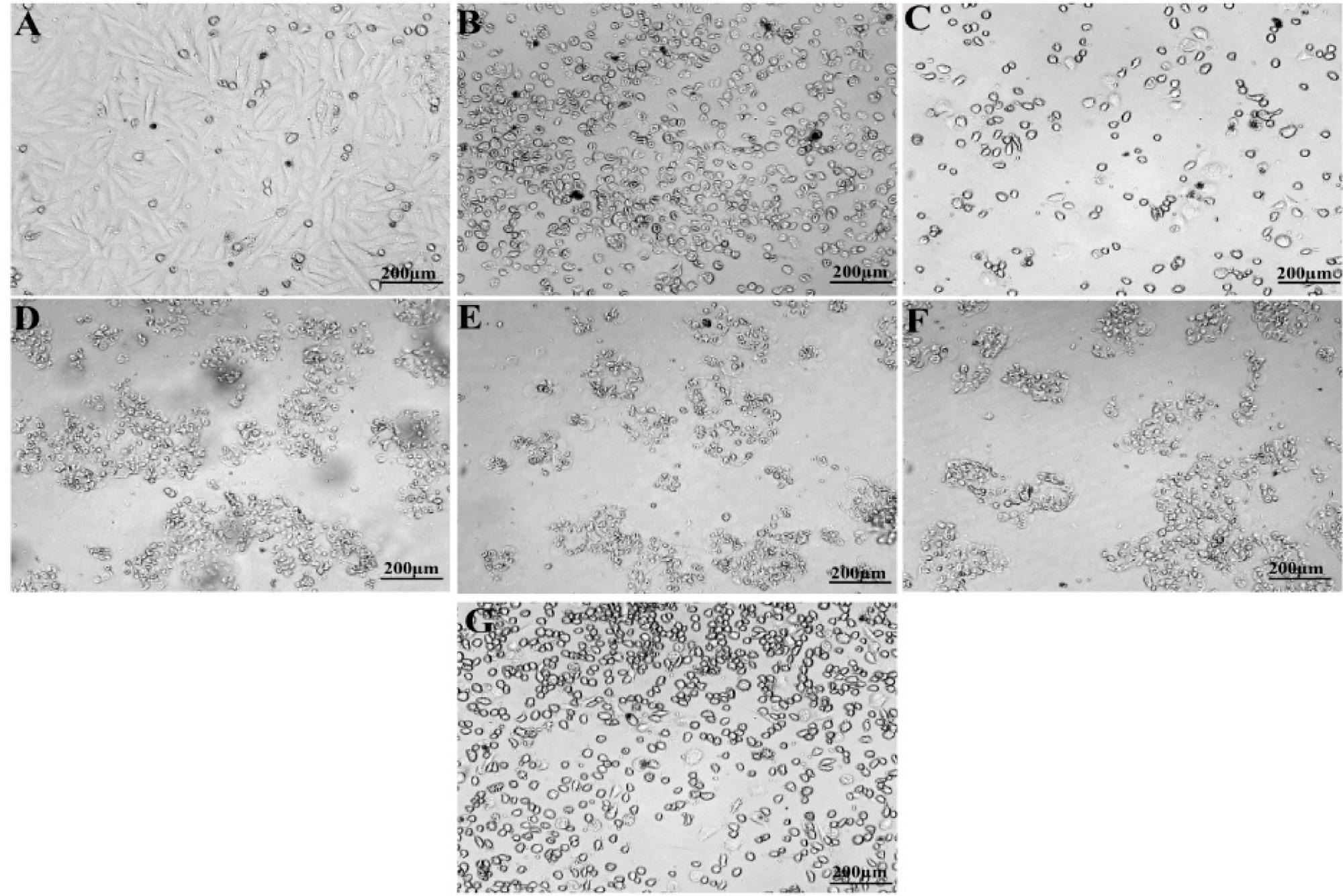 MTT assay of P-AgNPs from P. alba leaf extract against U118 MG cancer cell line. (A) Untreated cells, (B) Positive control, (C) 6.25 µg/mL, (D) 12.5 µg/mL, (E) 25 µg/mL, (F) 50 µg/mL, (G) 100 µg/mL.
