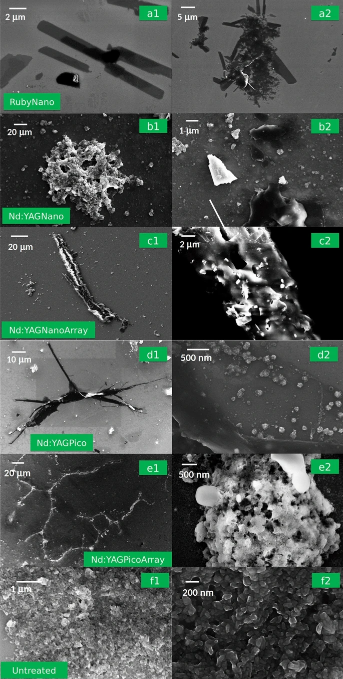 SEM images of GC ink treated with different lasers: (a1,a2) RubyNano, (b1,b2) Nd:YAGNano; (c1,c2) Nd:YAGNanoArray; (d1,d2) Nd:YAGPico; (e1,e2) Nd:YAGPicoArray, and untreated: (f1,f2).