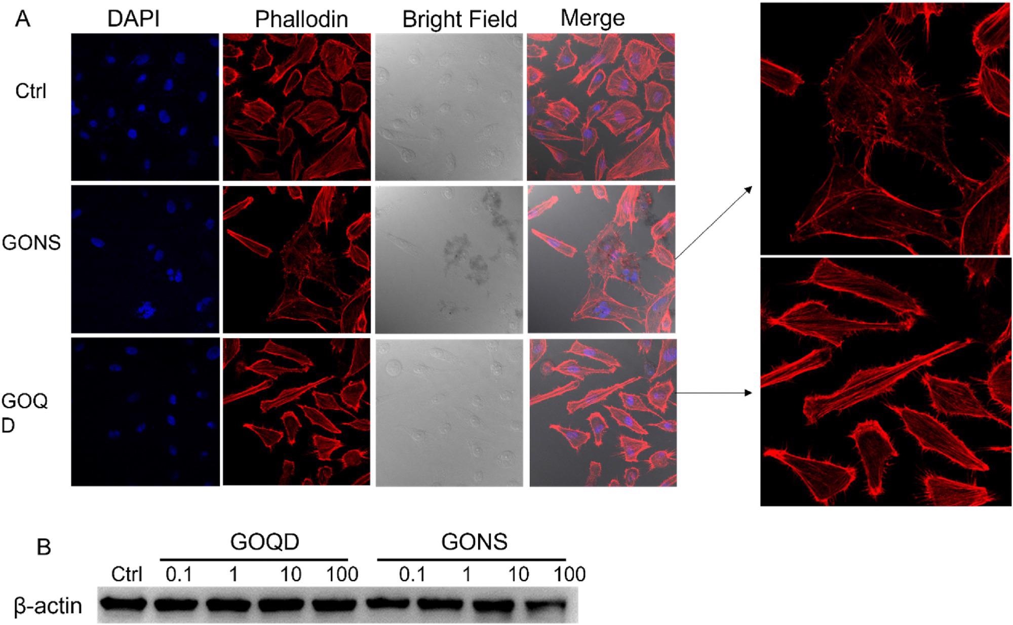 A) Morphology changes of induced by GONS and GOQD observed by confocal microscope. B) Western blot detecting ß-actin expression level when LX-2 incubated with GO quantum dots and nanosheets ranging from 0.1 to 100?m/l for 24?h. The expression level of ß-actin decreased after LX-2 incubated with 100?mg/l GO nanosheets. © Gui, X., Hu, G., Jie, Z. et al. (2022)