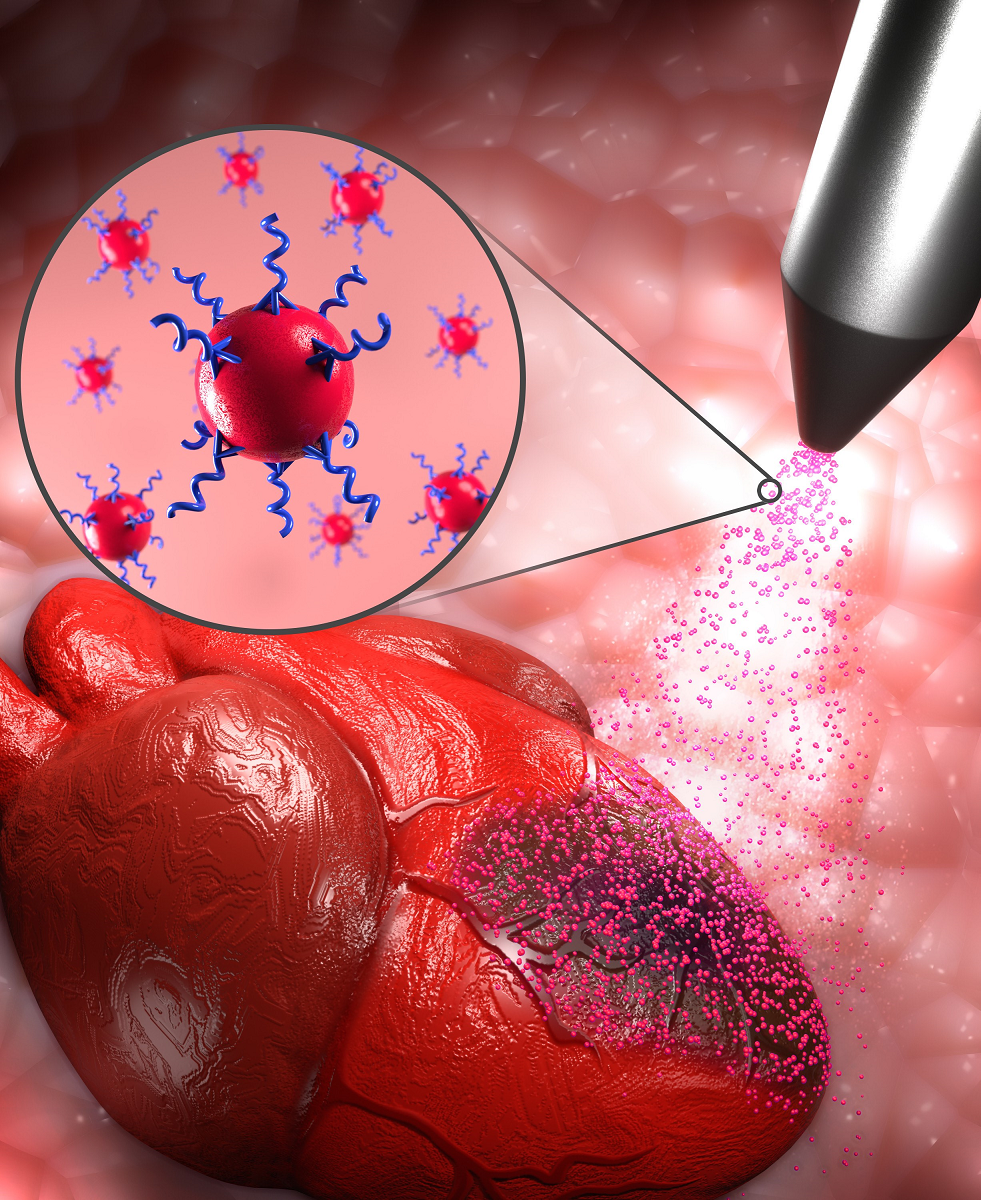 Spray-On Nanotherapeutic Restores Heart Function and Electrical Conductivity.