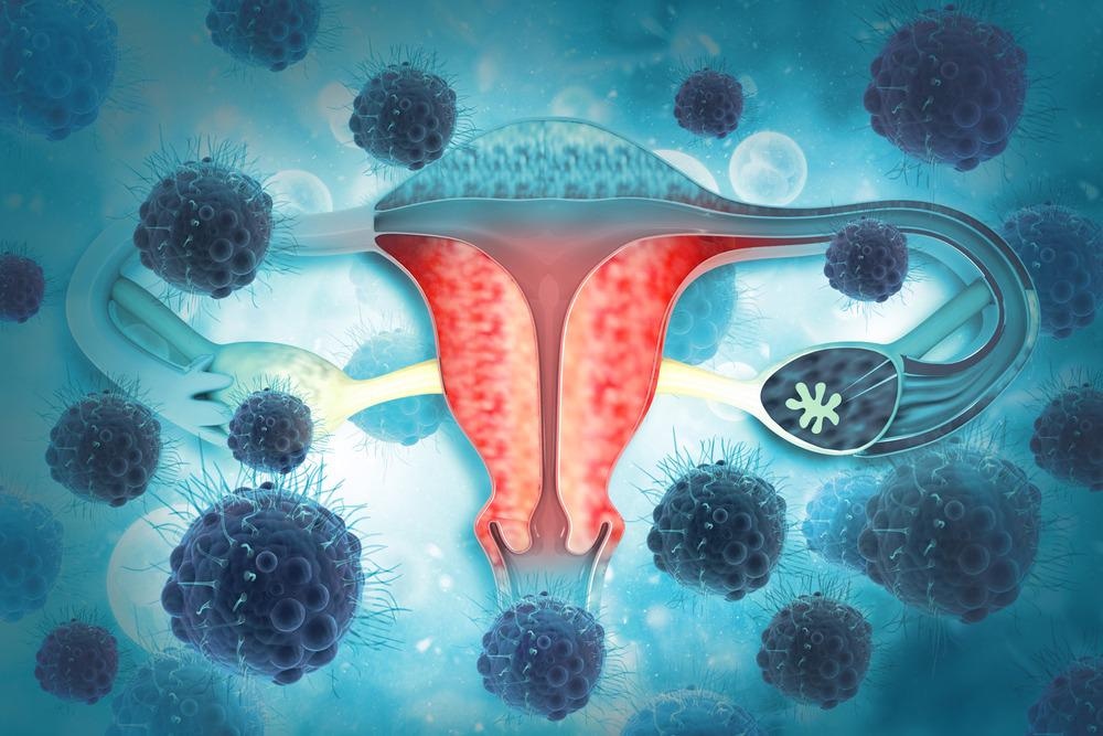 Nano-Enabled Identification of Ovarian Cancer Biomarkers