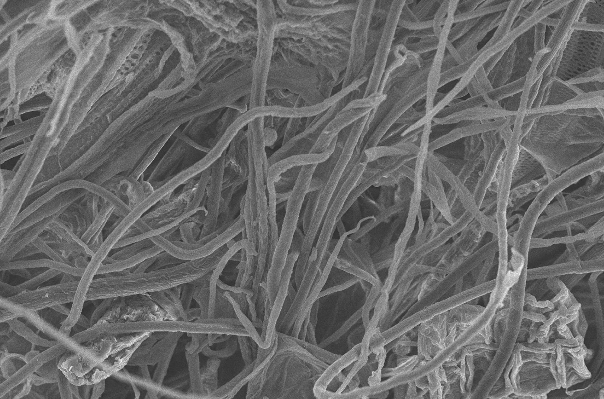 Nanocellulose Splendid Alternative for Sustainable Water Purification