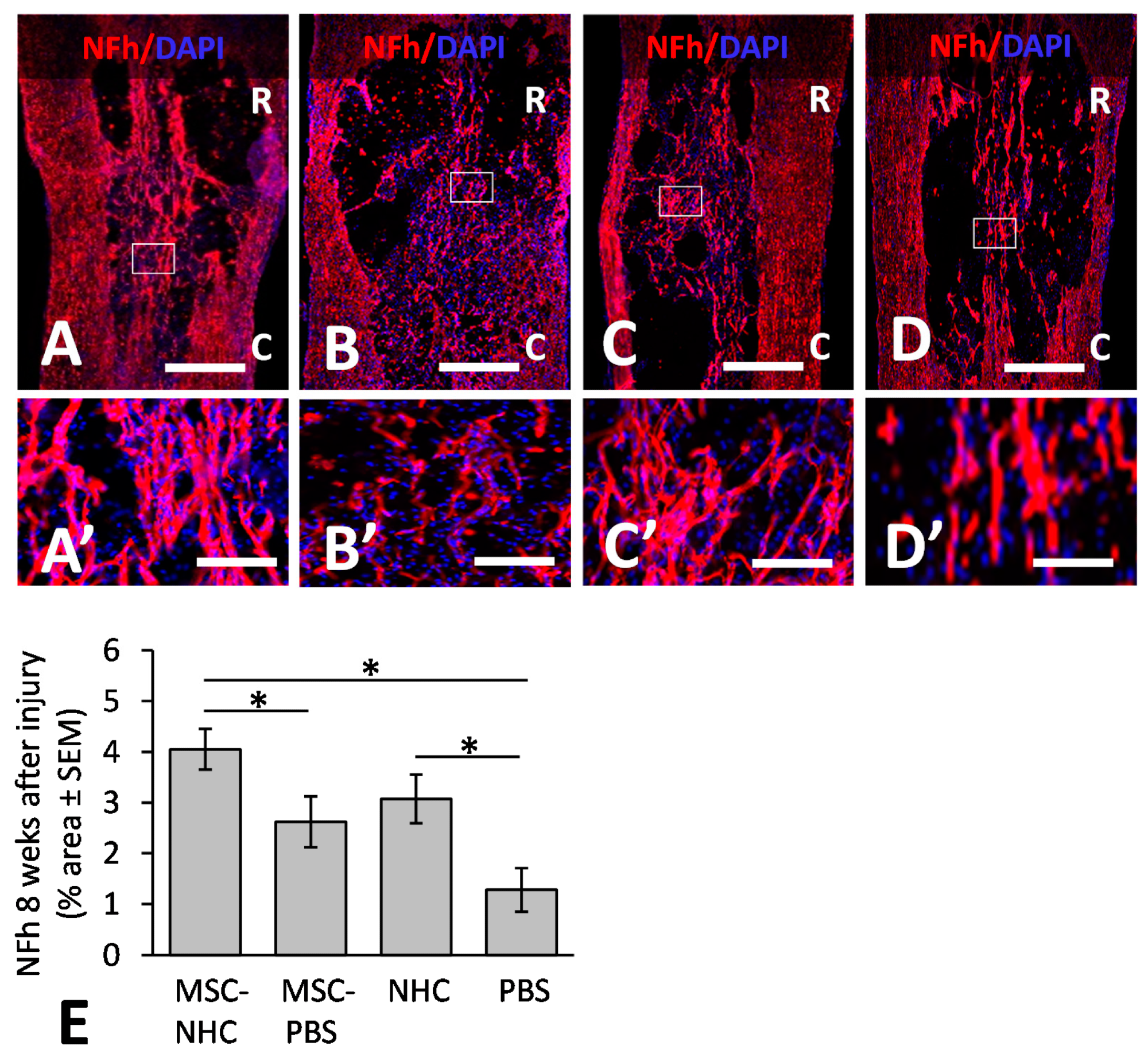 Axon presence in the injury site. Photomicrographs showing axons stained for NFh (red) in the injury site with MSC-NHC (A), MSC-PBS (B), NHC (C), or PBS (D) at 8 weeks after injury. Sections were counterstained with the nucleus marker, DAPI (blue). Images in panels (A’–D’) are enlargements of the outlined area in panels (A–D), respectively. The scale bar in (A–D ) is 450 µm. Scale bar in (A’,C’) is 125 µm, and 115 µm in (B’,D’). In (A–D), the rostral (R) and caudal (C) orientation of the horizontal sections are indicated. (E) Bar graph of the percentage area of injury site positive for NFh at 8 weeks after injury. There were significantly more NFh+ axons in the injury site with MSC-NHC compared with MSC-PBS and PBS only. Asterisks indicates p < 0.05. Bars in the graph represent SEM. Abbreviations: DAPI = 4