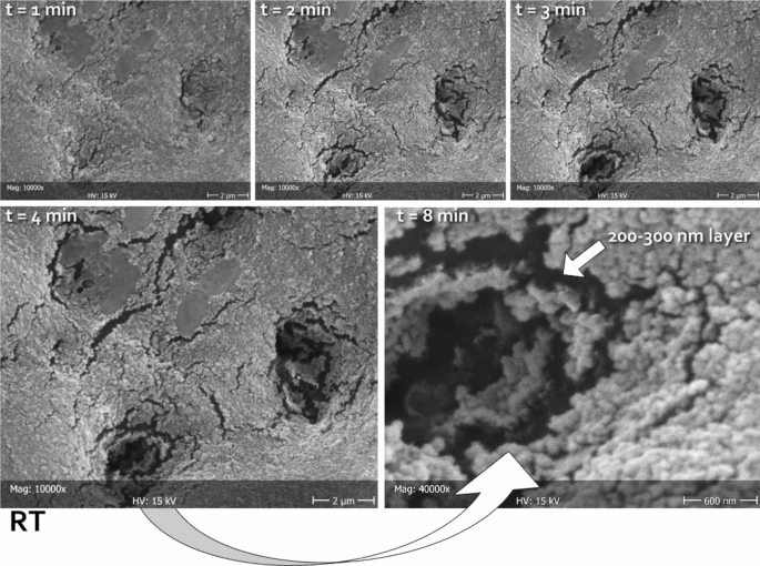 Representative micrographs of the same area (in this case belonging to RT), scanned at different times (1, 2, 3, 4, and 8 min) focusing the electron beam on the opening of tubules, thus heating the carbon-rich collagen structures underneath and disrupting the mineralized material obliterating the lumen. In this way, it was possible to measure the thickness of the deposited layer. The latter can be clearly seen as constituted by a homogeneous assembly of spherical nanoparticles. The absence of exposed HA prisms in this substratum did not allow for epitaxial growth; therefore, no HA nanocrystals could be identified independently from the tested formulations. Considering the treatment time that was allowed in this study (one week), it can be speculated that the tested formulations might need to incorporate a scaffold in order to be able to grow organized structures on the dentinal substrate.