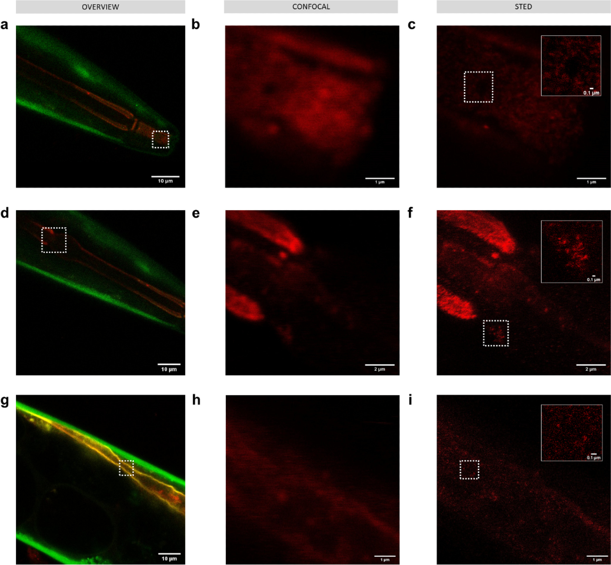 Imaging 50 nm polystyrene nanoplastics passively labeled with Atto 647N (red) in C. elegans KWN117 adult expressing GFP (green) in the body wall and mCherry (yellow) in the apical intestinal membrane. Confocal overview and high resolution of confocal and STED images of the scanned area indicated by white boxes for parts of the digestive track in the mouth (a–c), pharynx (d–f), and intestine (g–i). Insets in STED images correspond to the areas indicated by white boxes.