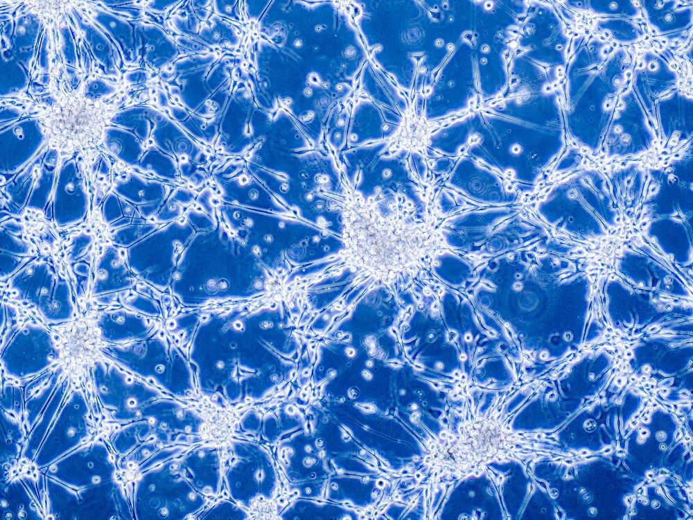How Nanomedicines can Shape the Future of Glioblastoma Therapy