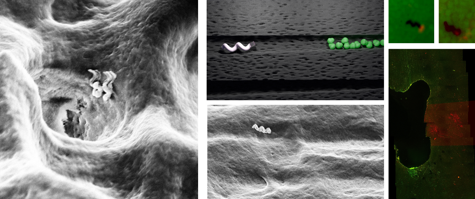 Researchers Develop Nanobot That Can Assist In Accurate Root Canal Treatments.