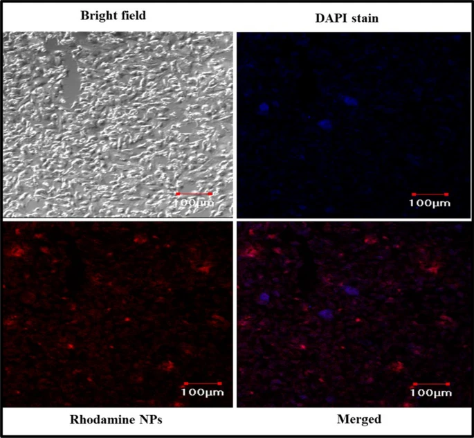 Cellular uptake study of nanoparticles in A549 cell lines imaged using confocal laser scanning microscope (CLSM).