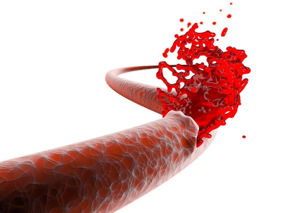Nanofiber Aerogel to Control Bleeding from Penetrating Wounds