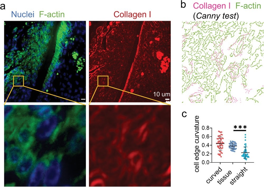 Immunofluorescence staining displays widely distributed cell bridges in the periodontal ligament.  a) The representative fluorescence images of nuclei (blue), F-actin (green), and collagen I (red) staining of the mouse periodontal ligament.  b) Canny edge test image of the yellow box area in (a).  The magenta and green represent collagen I and F-actin, respectively.  c) The average curvature of the cell edges (n = 50, two technical replicates) of the cells in the periodontal ligament and cultured on the artificial fibers.??????