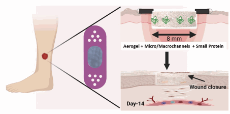 Nanofiber Aerogels for Rapid Diabetic Wound Healing