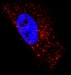 New Type of Probe Allows Scientists to Visualize Single RNA Molecules within Live Cells