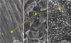 Increasing the Active Surface of Dental Implants at Nano Level Quickens Healing